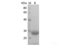 Recombinant Mouse S100B Protein (His Tag)