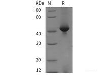 Recombinant Mouse CHI3L1/YKL40 protein (His tag)