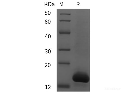 Recombinant Mouse FABP5 protein (His tag)