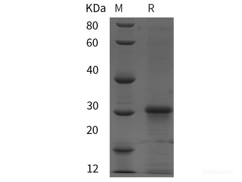 Recombinant Mouse ACTH protein (His tag)