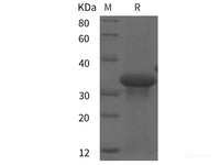 Recombinant Mouse Tn-I protein (His tag)