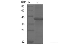 Recombinant Mouse Pcsk9 protein (GST tag)