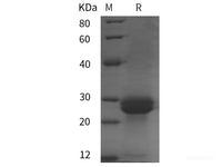 Recombinant Mouse IL-33 protein (His tag)