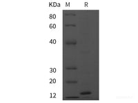 Recombinant Mouse Esm1 protein (His tag)