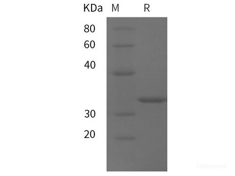 Recombinant Mouse IL1A/IL-1A/IL-1F1 protein (His tag)