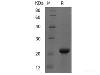 Recombinant Mouse BRAF35 protein (His tag)