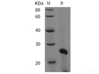 Recombinant Mouse HP1α protein (His tag)