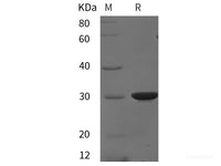 Recombinant Mouse BCR protein (His tag)