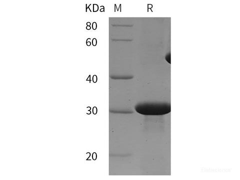 Recombinant Mouse TGFBR2 protein (His tag)