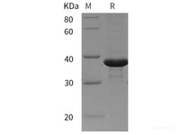 Recombinant mouse TGF-beta 2/TGFB2 protein (His tag)