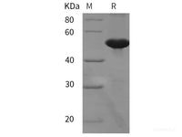 Recombinant Mouse FGA/Fibrinogen A protein (His tag)