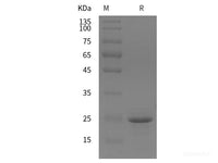 Recombinant Mouse CD146/MCAM protein (His tag)