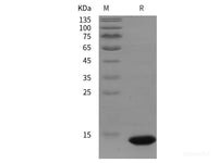 Recombinant mouse IGF1/IGF‑I/IGF-1 protein (His tag)