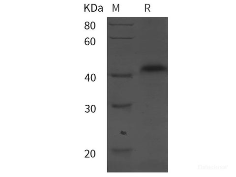 Recombinant Mouse CD62L/L-Selectin protein (His tag)