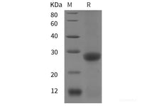 Recombinant Mouse CD20/MS4A1 protein (His tag)