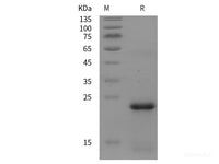 Recombinant Mouse FTMT Protein (His tag)