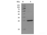 Recombinant Mouse MUC16 protein (His tag)