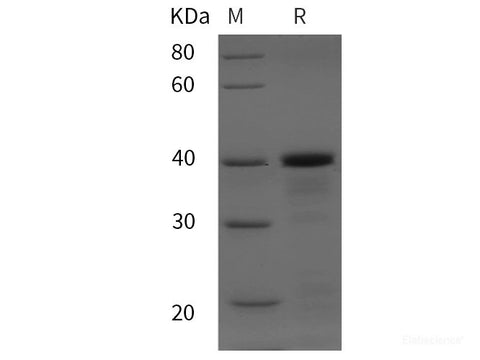 Recombinant Gekko japonicus PDGFC protein (His tag)