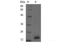 Recombinant chiken IL2/IL-2/Interleukin-2 protein (His tag)