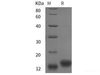 Recombinant chiken IGF1/IGF‑I/IGF-1 protein (His tag)