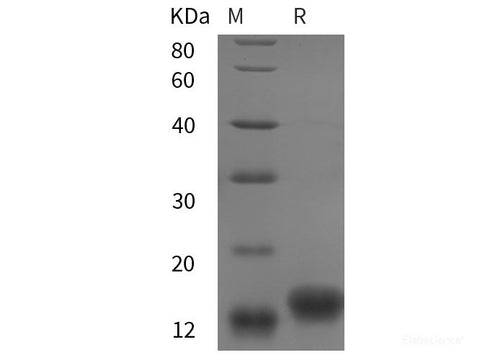 Recombinant chiken IGF1/IGF‑I/IGF-1 protein (His tag)