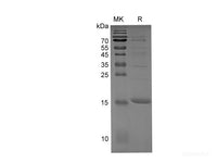 Recombinant Rabbit IL1B protein(His tag)