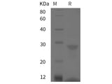 Recombinant Porcine S100A12 protein (His tag)