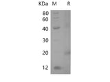 Recombinant Rat Alpha-fetoprotein Protein (His Tag)