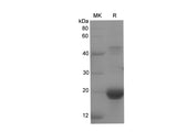 Recombinant Rat AMPK alpha2 Protein (His Tag)