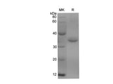 Recombinant Rat CD147/BSG/Basigin Protein (His Tag)