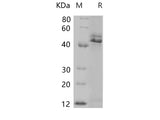 Recombinant Rat CD75/ST6GAL1 Protein (His Tag)