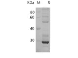 Recombinant Rat DNMT1 Protein (His Tag)