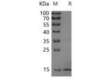 Recombinant Rat FGF2 Protein (His Tag)