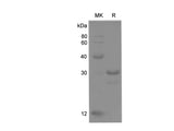 Recombinant Rat Lamin B1 Protein (His Tag)