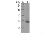 Recombinant Rat IL4 protein(His tag)