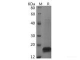 Recombinant Rat TNF-αsf protein(His tag)