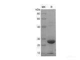 Recombinant Rat S100B protein(His tag)