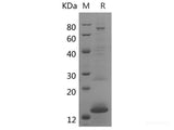 Recombinant Rat NEFL protein(His tag)