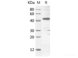 Recombinant Rat C4a protein(GST tag)