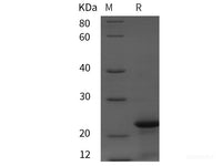 Recombinant Rat Calcitonin/CT protein (TRX,His tag)