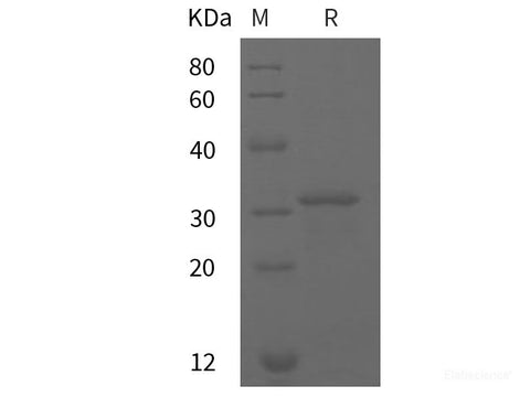 Recombinant rat GSTp1 protein (His tag)