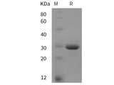 Recombinant Rat ANG2 protein (His tag)