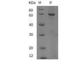 Recombinant Rat Amine oxidase A/MAOA protein (His tag)