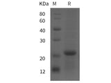 Recombinant Rat CRH protein (His tag)