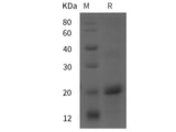 Recombinant Rat MCP-1 protein (His tag)