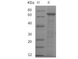 Recombinant Rat C4 protein (His tag)