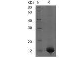 Recombinant Rat RUNX2/CBFA1 protein (His tag)