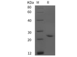 Recombinant Rat Adrenomedullin/ADM protein (His tag)