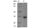 Recombinant Rat Clusterin/ApoJ protein (His tag)