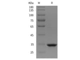 Recombinant Rat MMP-2/CLG4A protein (His tag)